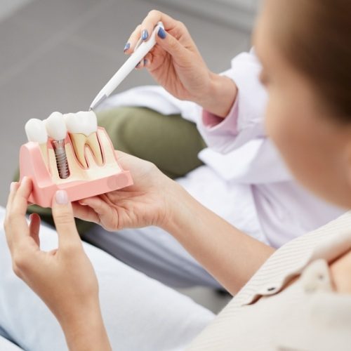 Dentist and dental patient looking at dental implant model