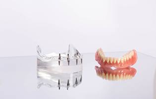 Clear base with sample implants next to complete lower arch of dentures on reflective surface