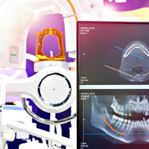3 D cone beam imaging system with screens showing models of the teeth and jaws