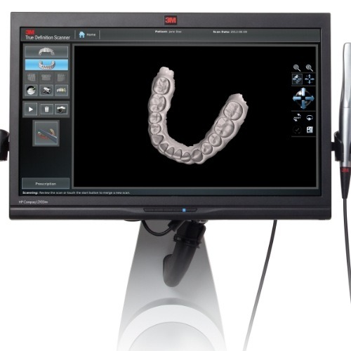 Screen showing model of row of teeth from digital dental impressions