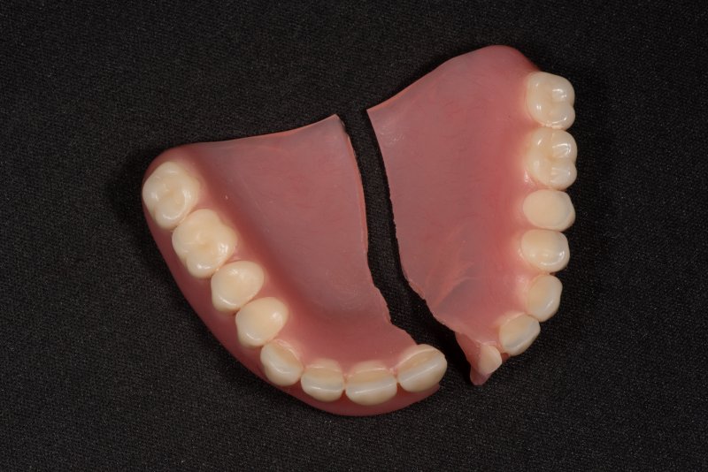 set of broken dentures lying on a table