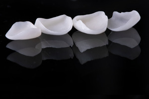 Four veneers lined up in a row
