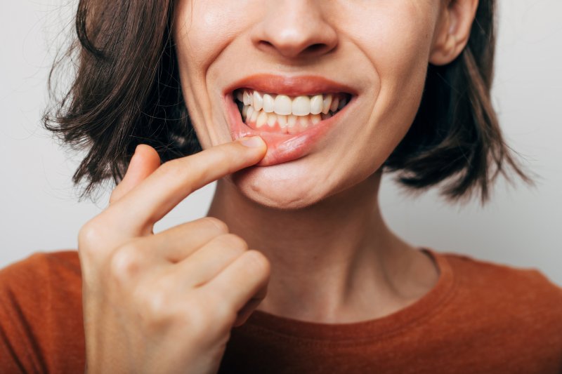 Woman shows gums
